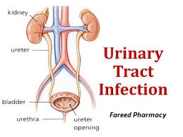 Urinary-Tract-Infection
